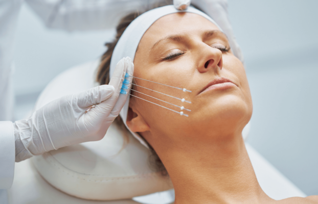 Threadlift: Genç ve Canlı Bir Görünüm İçin İğneli Yüz Germe İncelemesi